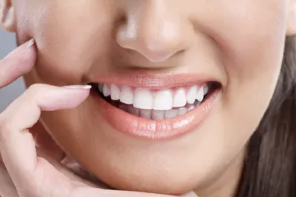 estetinis_plombavimas